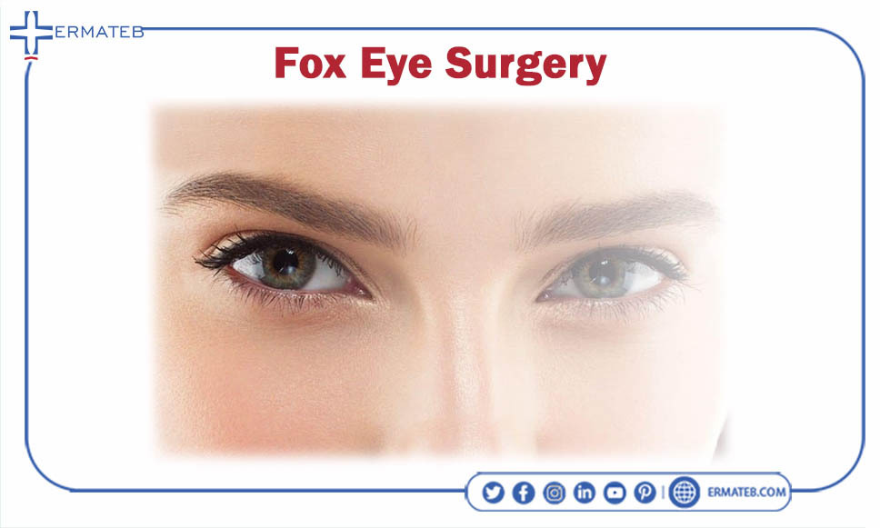 fox eye surgery